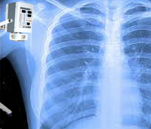 Radiografia al torace a domicilio
