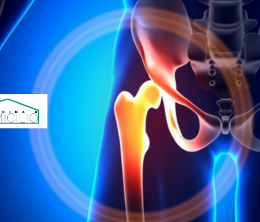 Radiografia del bacino (RX Bacino) e delle anche (RX anche)