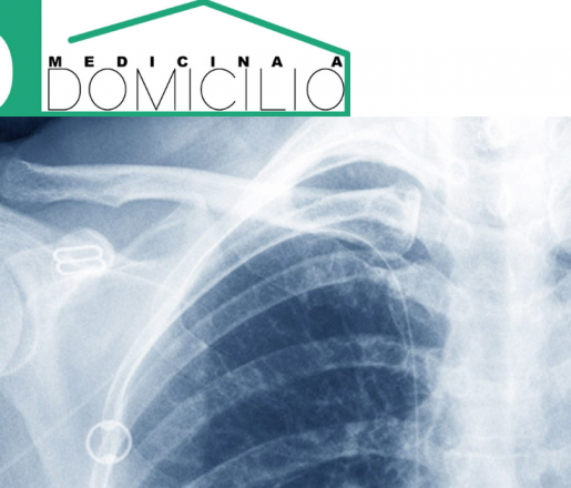 Cosa è la radiografia emicostato?