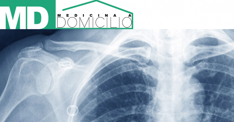 Cosa è la radiografia emicostato?